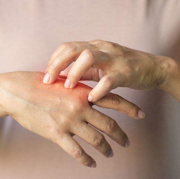 Delaware Burn Injury Lawyers Delaware Burn Injury Lawyers