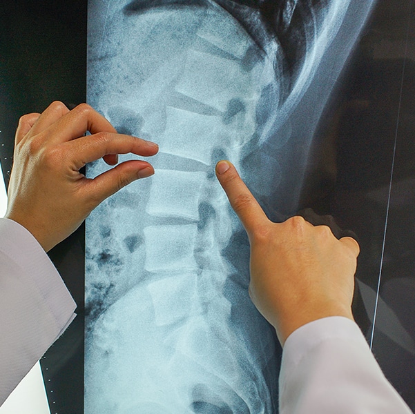 Delaware Brain and Spinal Injury Attorneys Delaware Brain and Spinal Injury Attorneys
