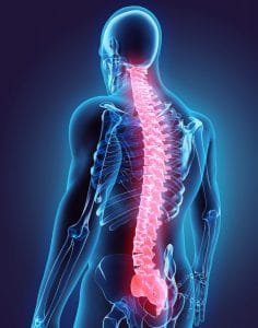 What Are the Levels of Spinal Cord Injuries?
